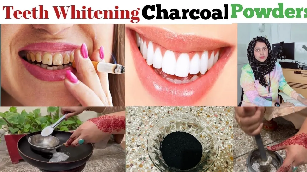 29032 smile after charcoal whitening