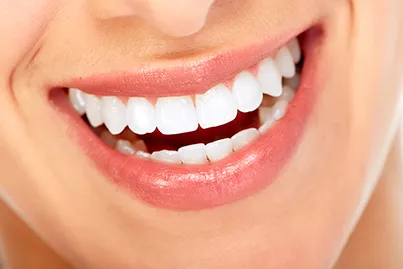 29034 over the counter teeth whitening