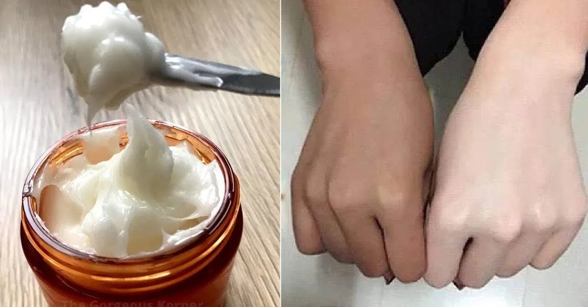 29035 homemade skin whitening cream storage