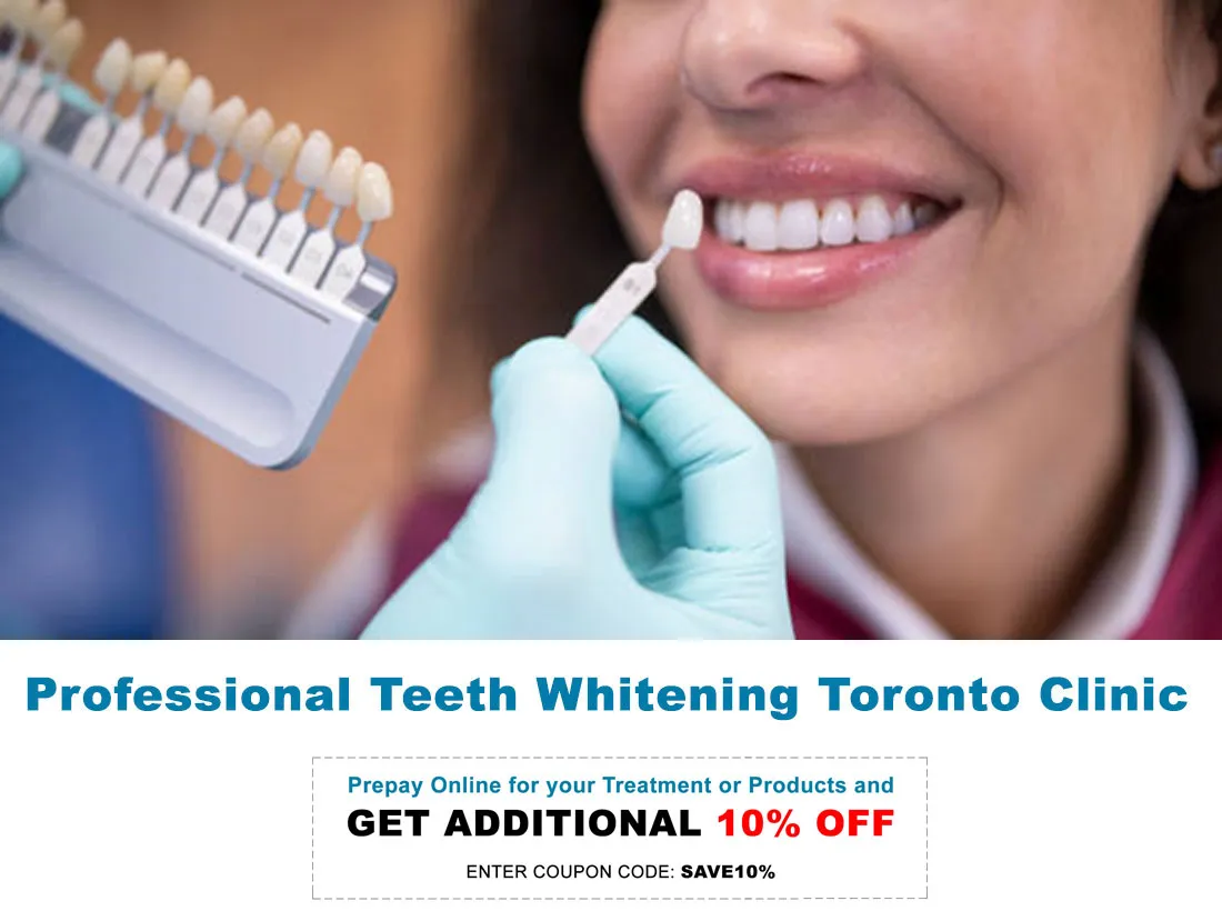 29037 take home teeth whitening kit