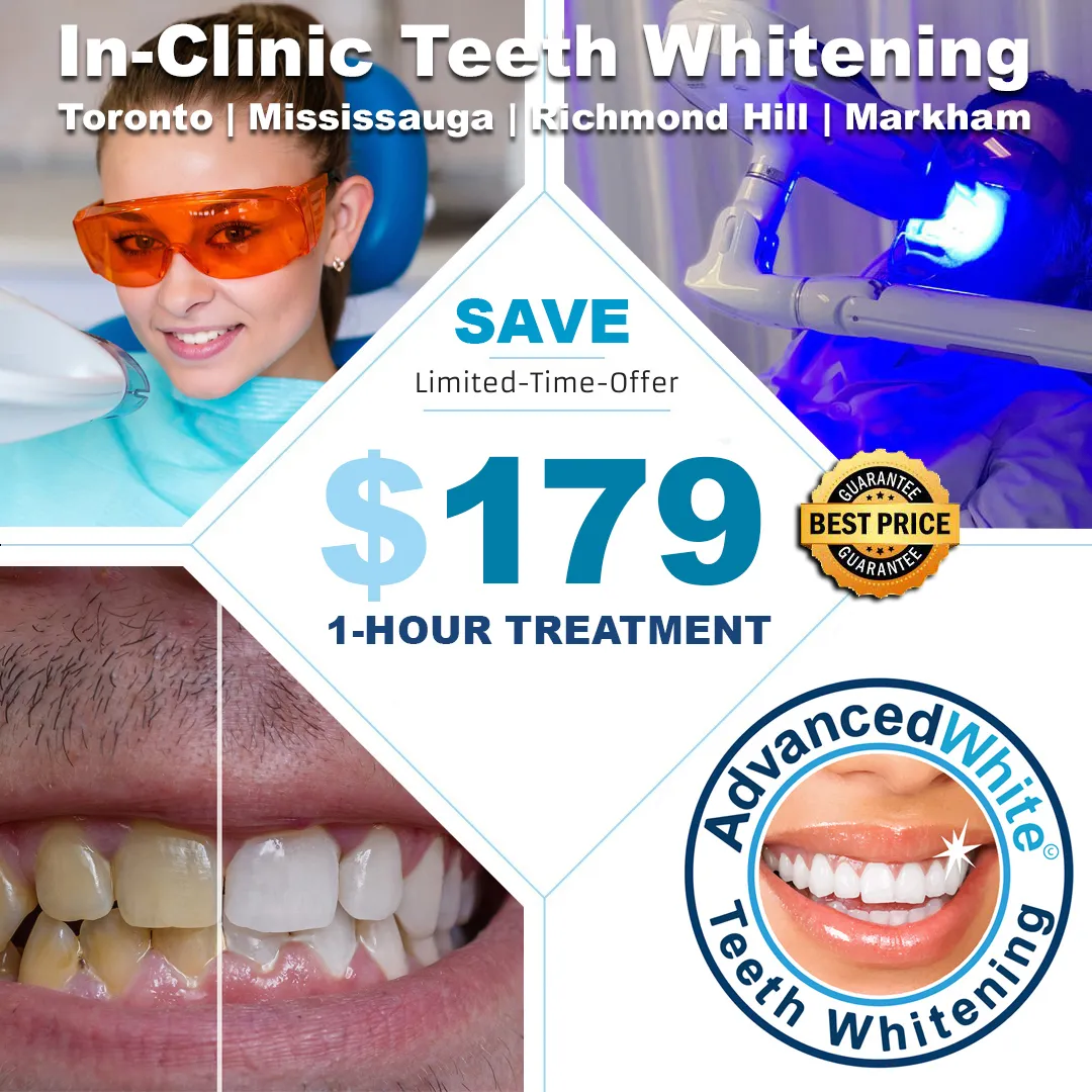 29037 teeth whitening toronto clinic