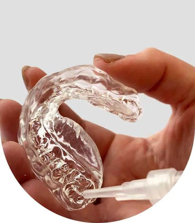 /img/29040-alternatives-to-teeth-whitening.webp