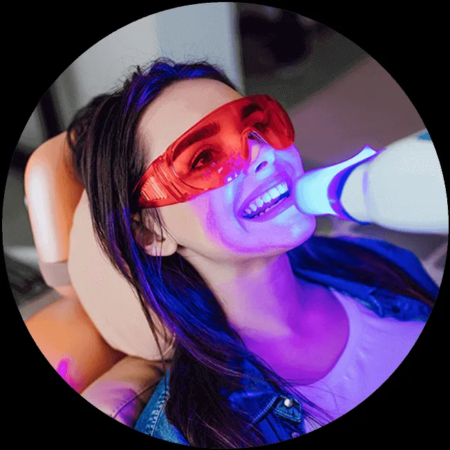 29040 take home teeth whitening kits