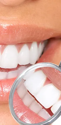29040 whitening toothpastes rinses