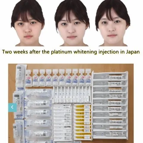 29041 whitening consultation