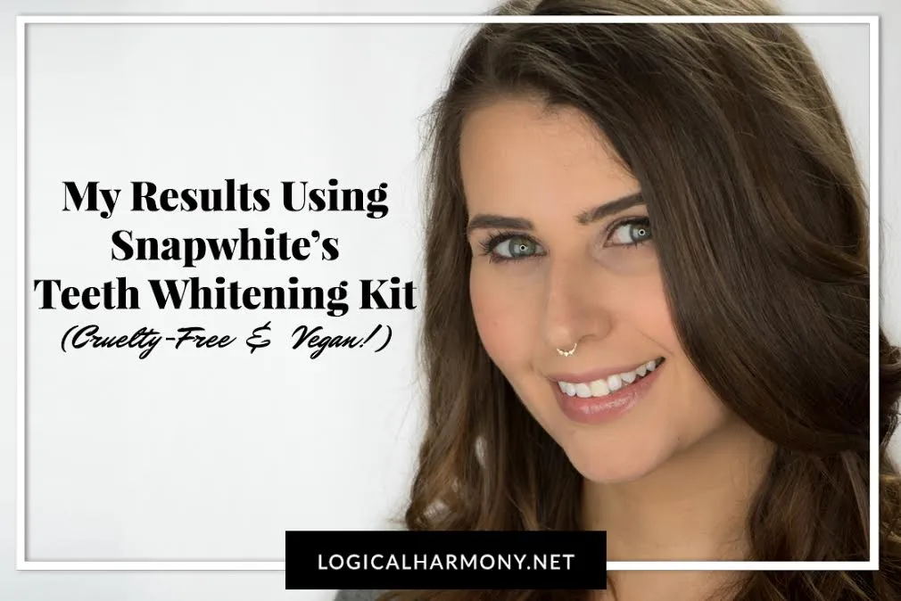 /img/29044-professional-teeth-whitening.webp