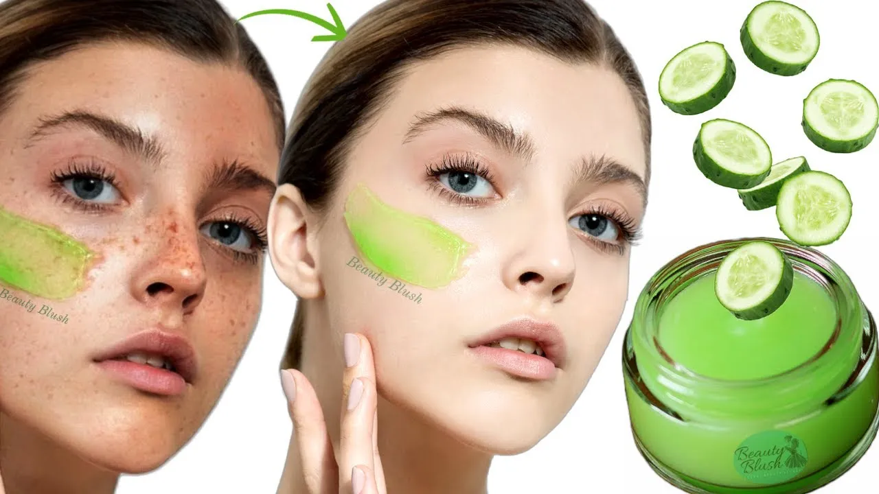 29045 understanding hyperpigmentation