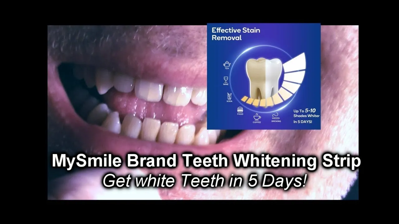 /img/29046-teeth-whitening-review-products.webp