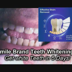 /img/29046-teeth-whitening-review-products.webp