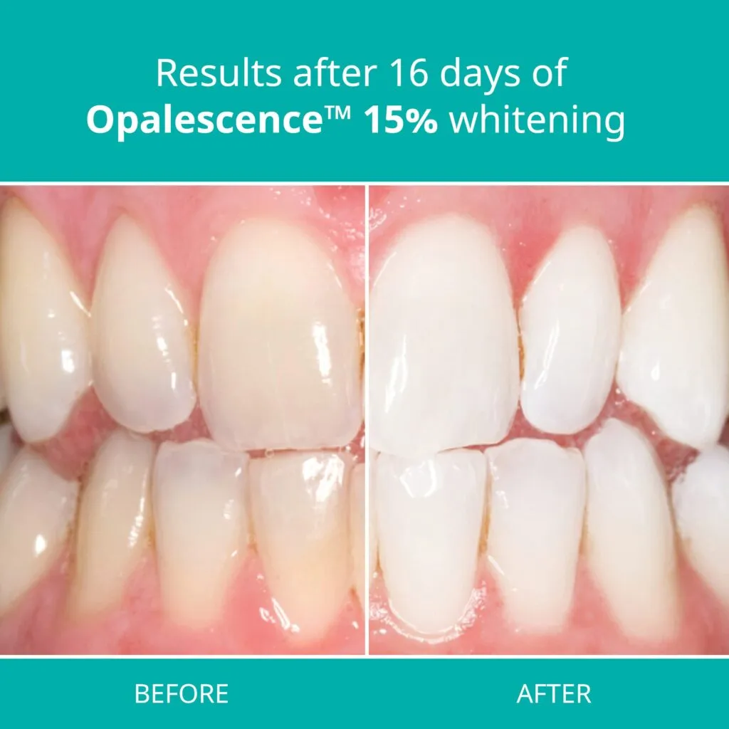 29049 teen dentist consultation