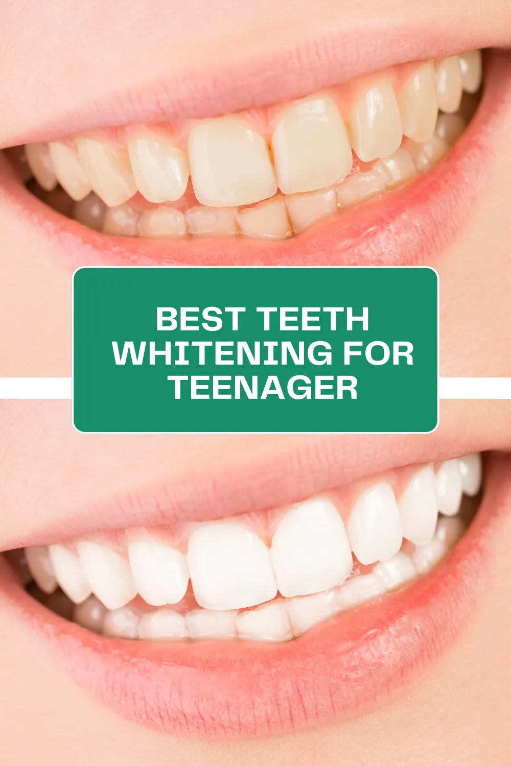 29049 teen oral hygiene