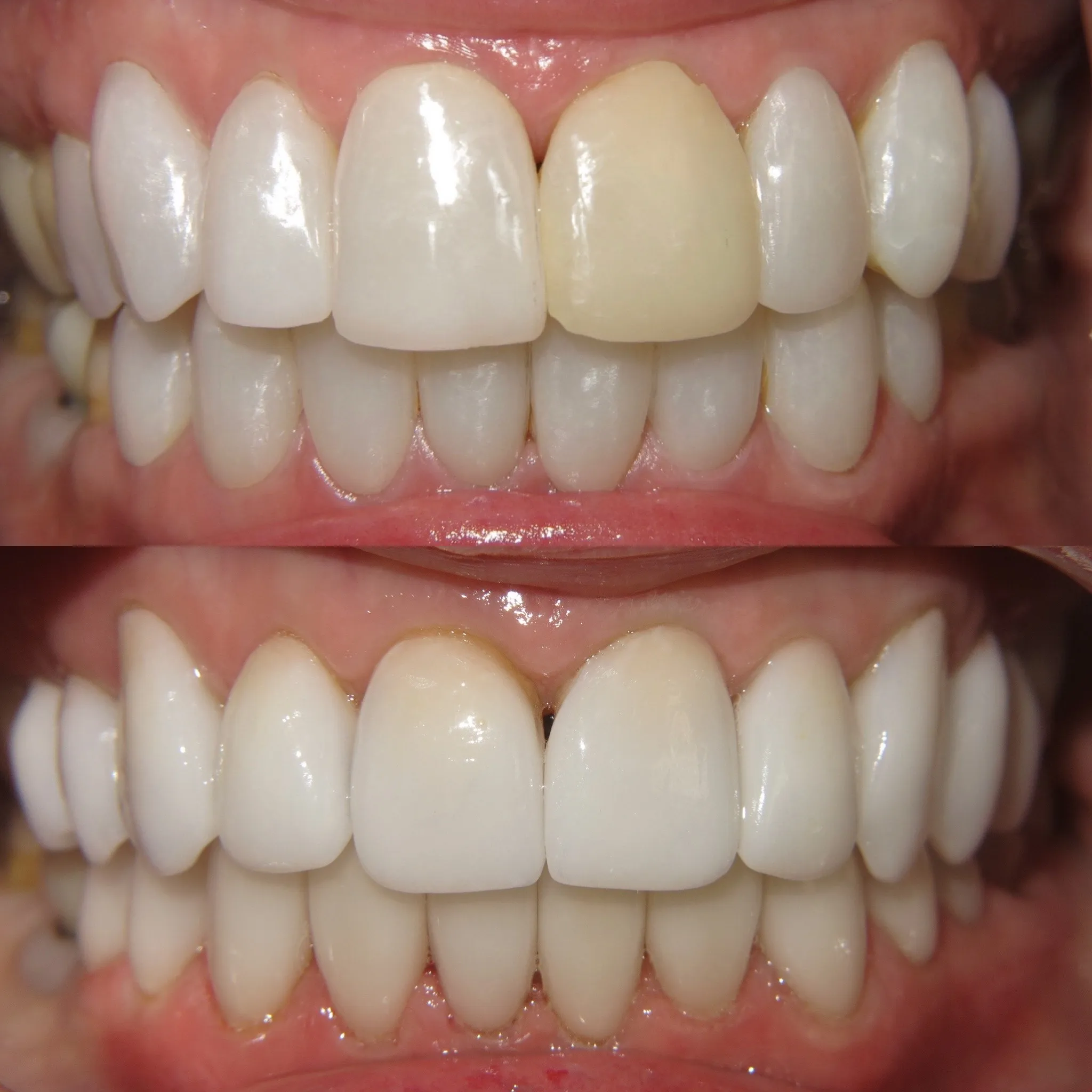 /img/29051-before-after-teeth.webp