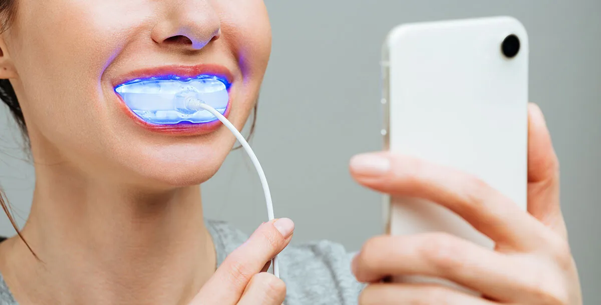 29051 teeth stain removal