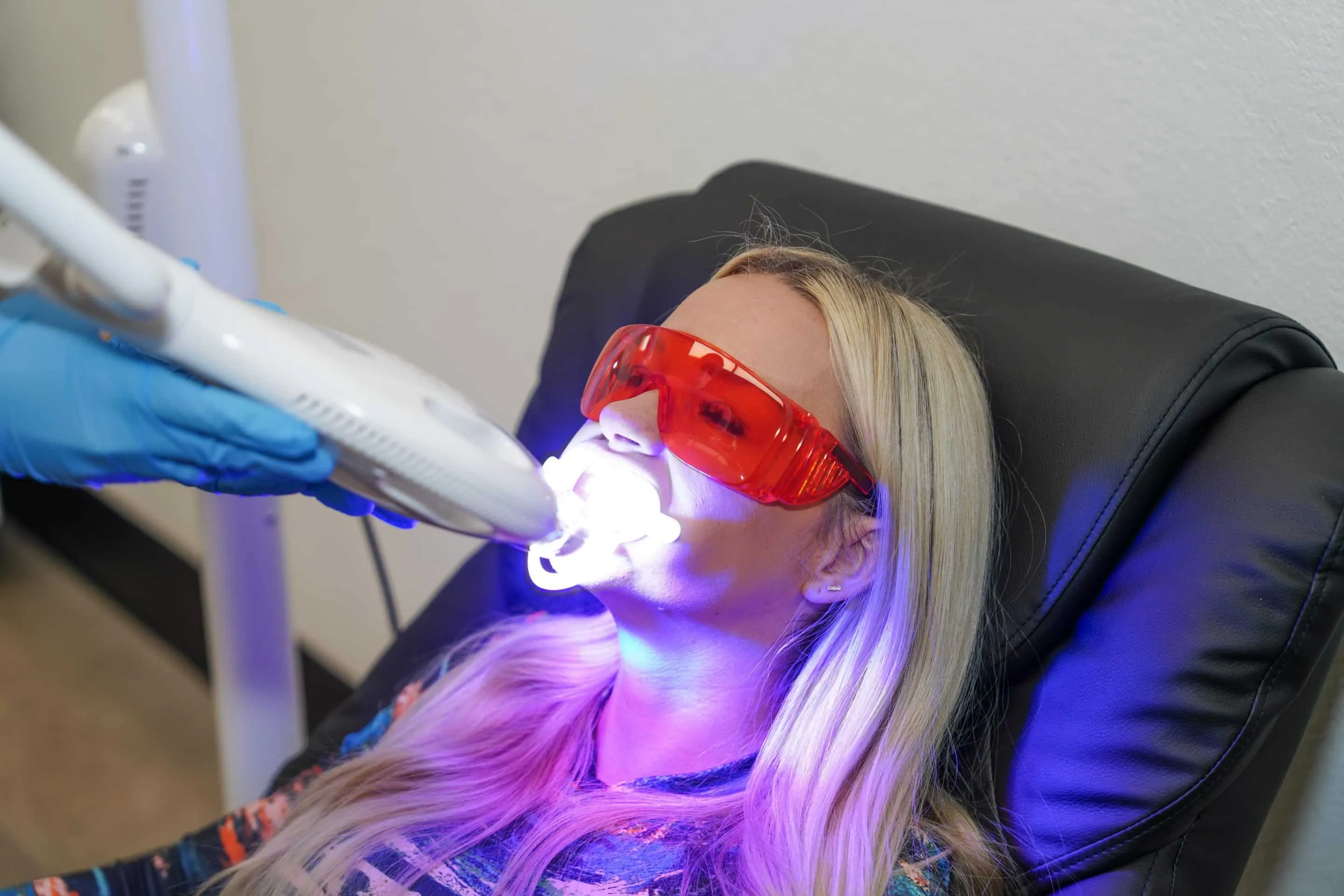 29052 teeth whitening process