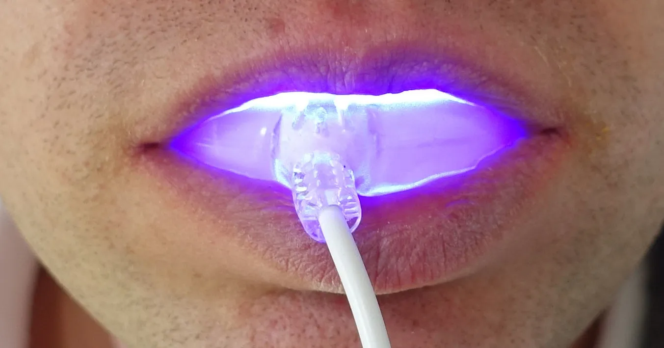 29054 hydrogen peroxide in teeth whitening
