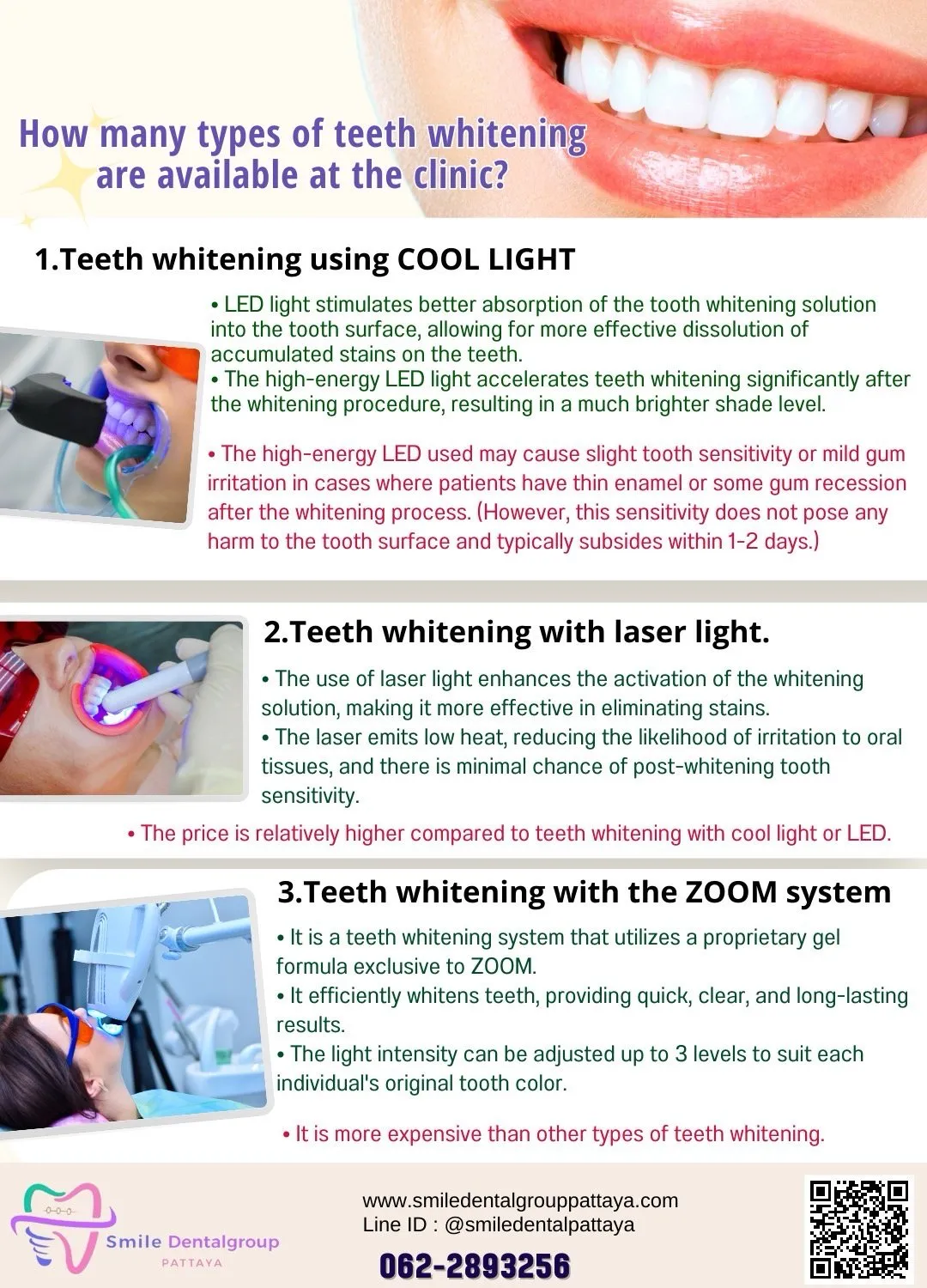 29055 at home teeth whitening