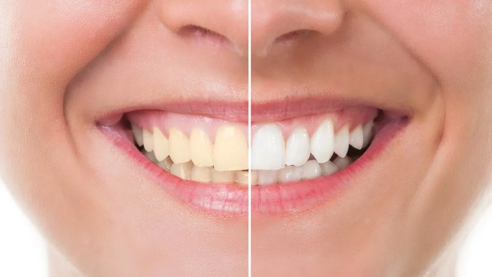 29060 healthy diet teeth