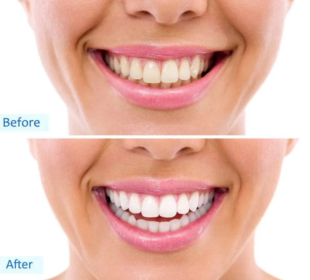 /img/29060-regular-checkups.webp