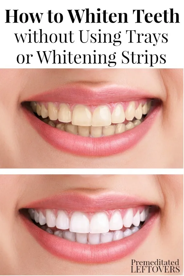 29061 teeth whitening gel before after