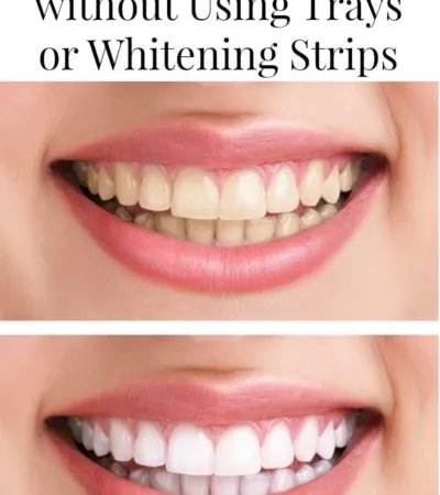 29061 teeth whitening gel cotton swab
