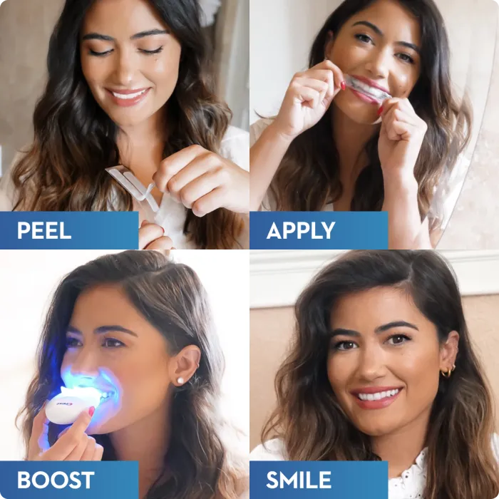 29062 teeth whitening comparison