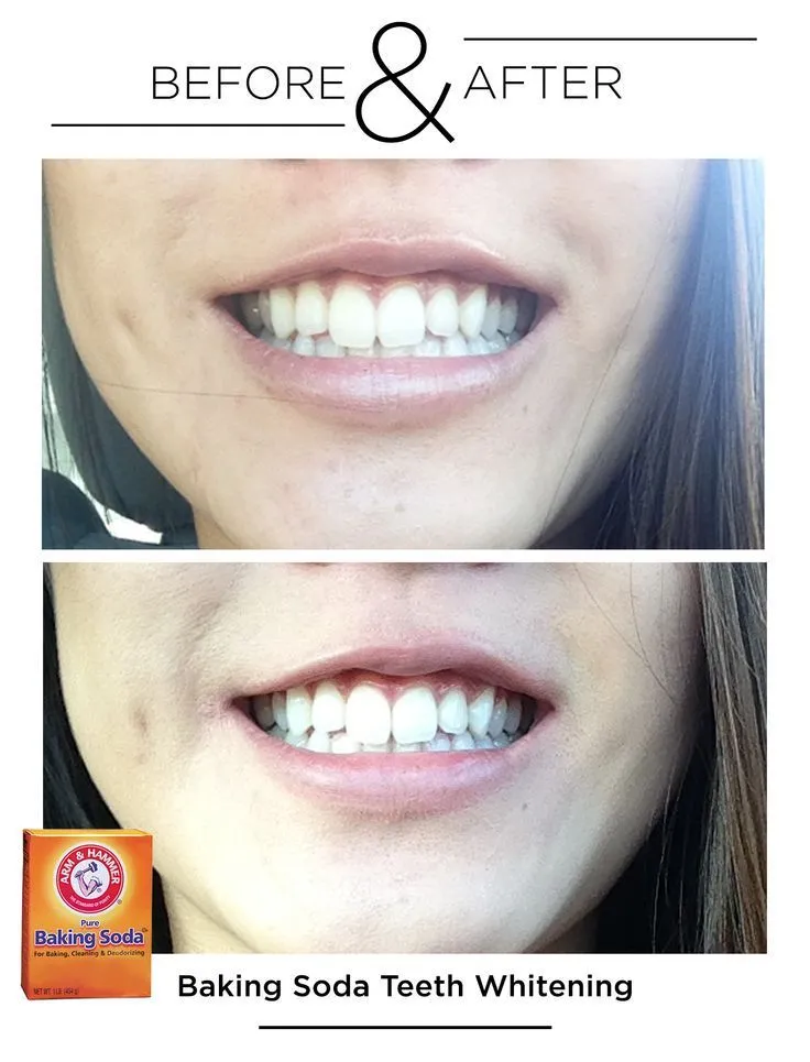 29063 dental checkup