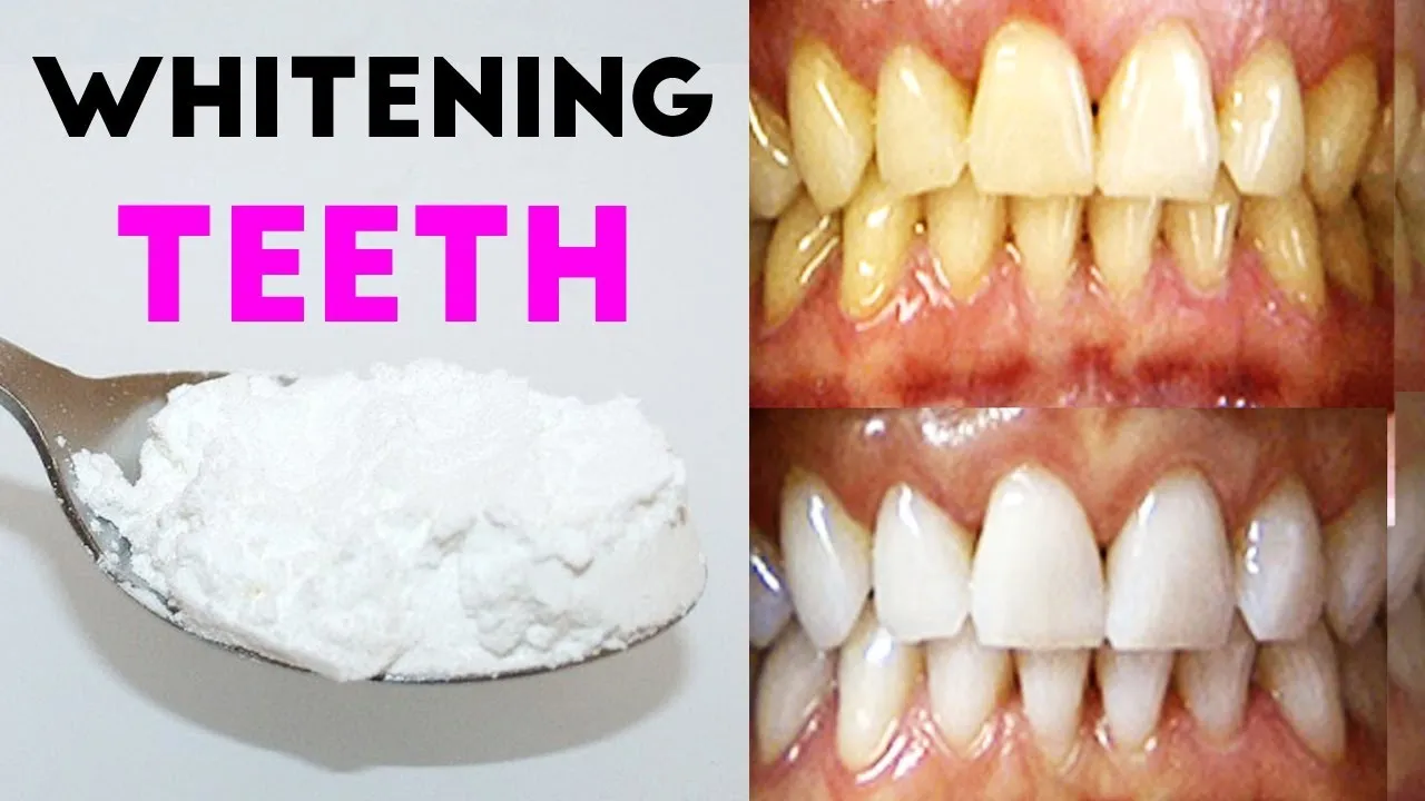 /img/29063-long-term-veneer-care.webp