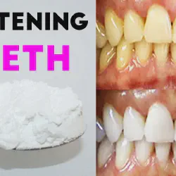 /img/29063-long-term-veneer-care.webp