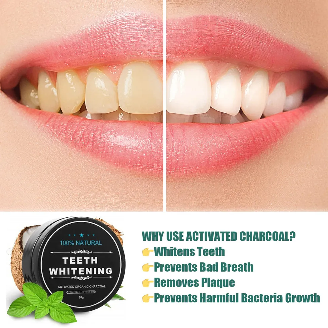 29064 whitening comparison