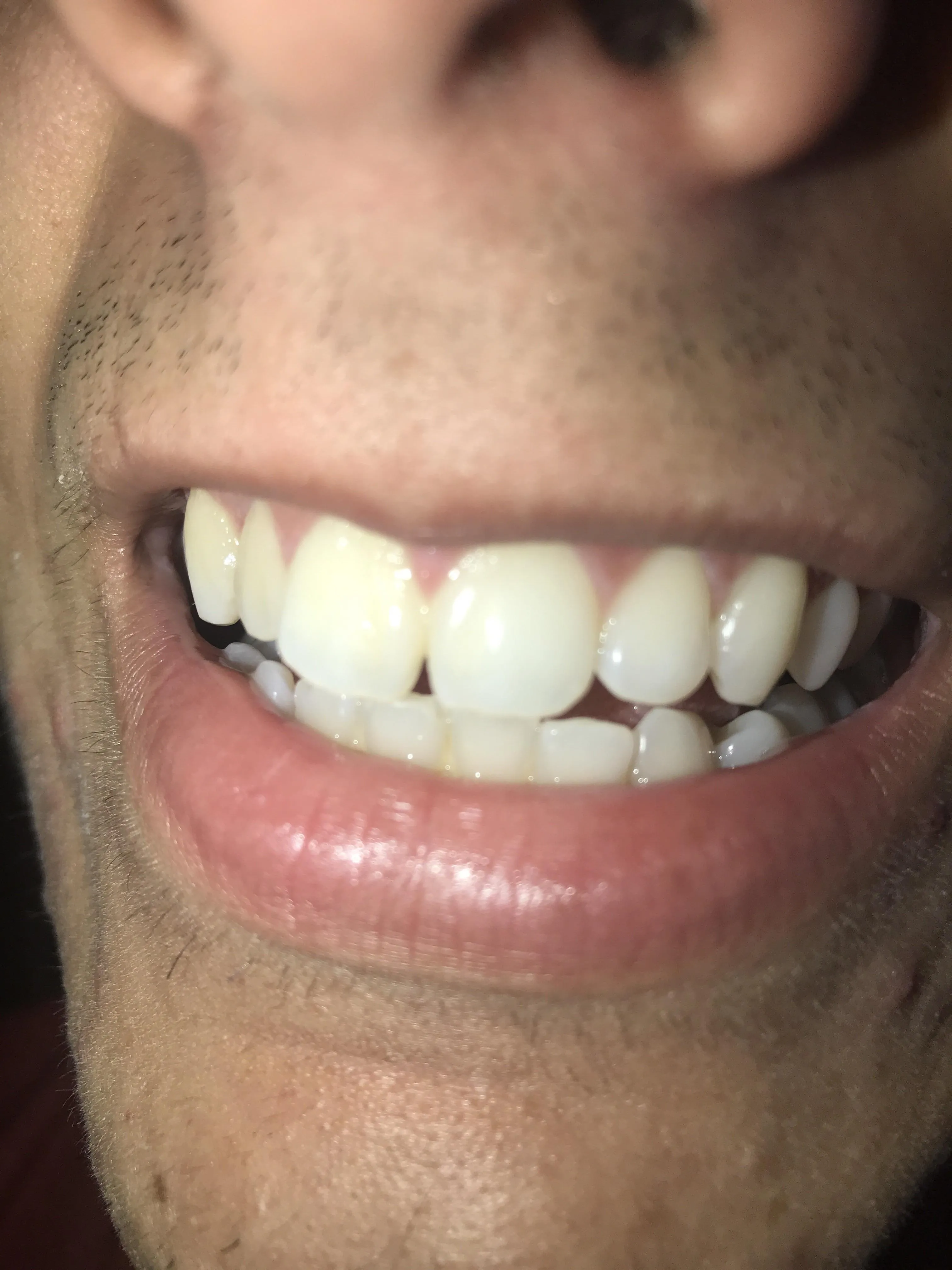 29065 whitening toothpaste