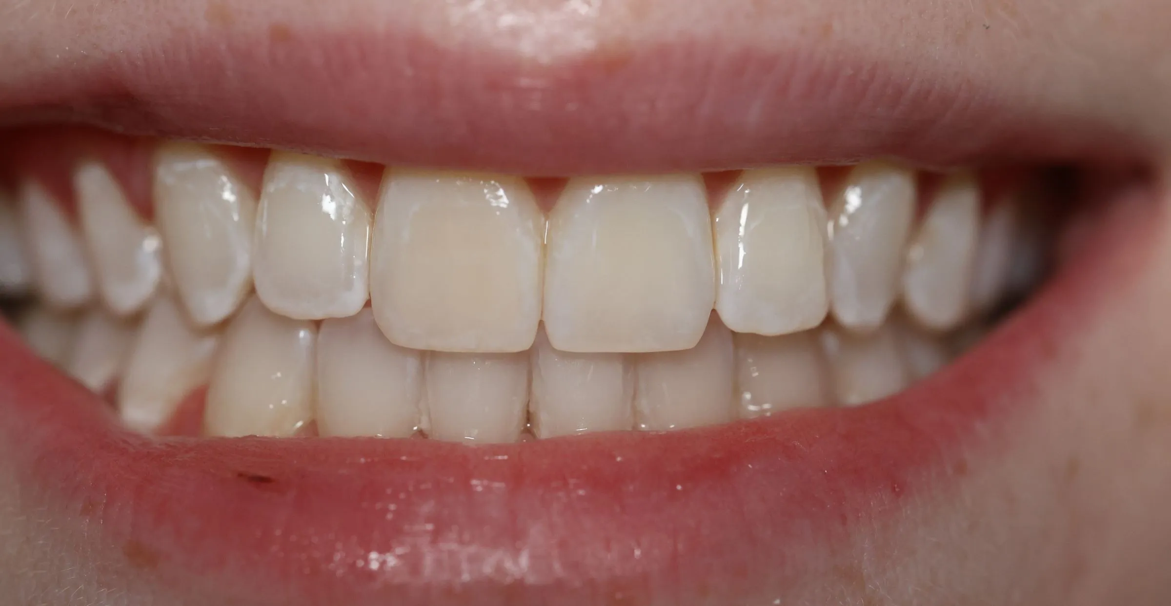 /img/29066-teeth-whitening-spa.webp