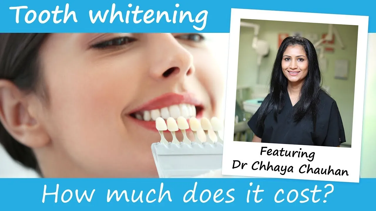 29067 professional teeth whitening