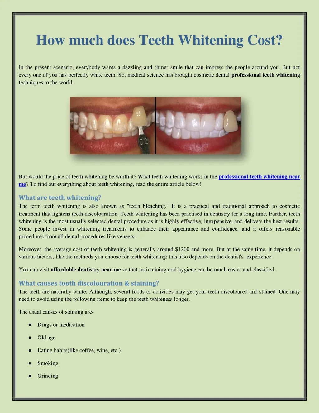 /img/29067-smile-makeover.webp