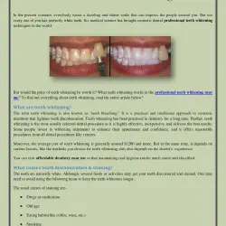 /img/29067-smile-makeover.webp