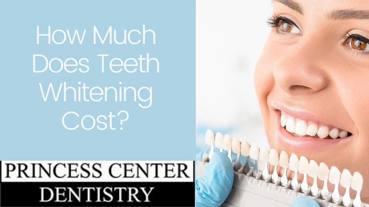 29067 teeth cleaning appointment