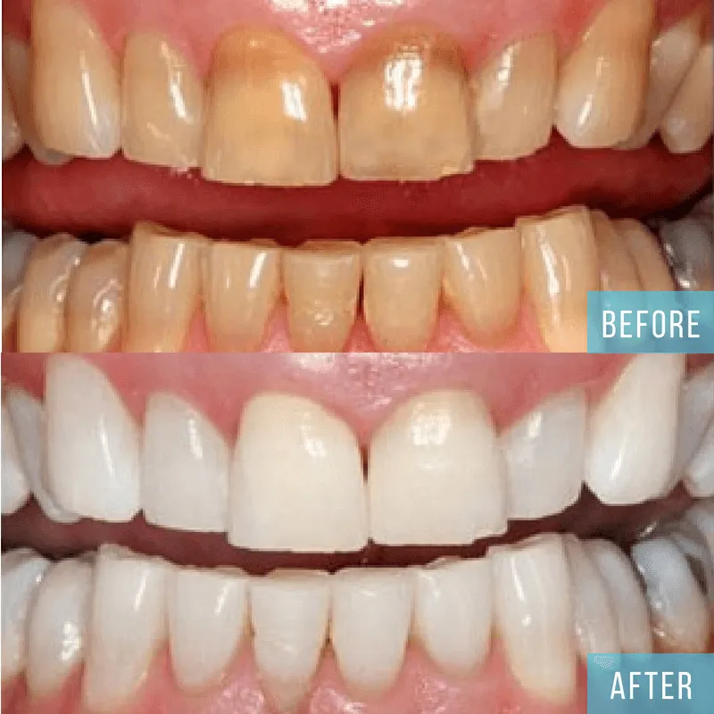 29069 dental checkup