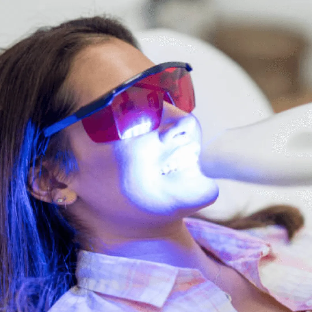 29069 professional whitening