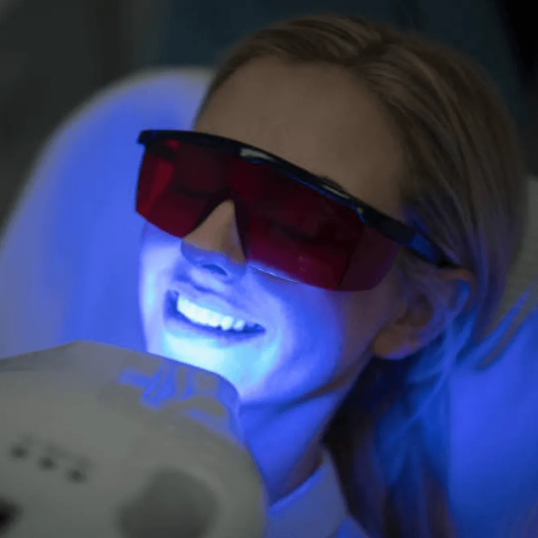 29069 whitening strips