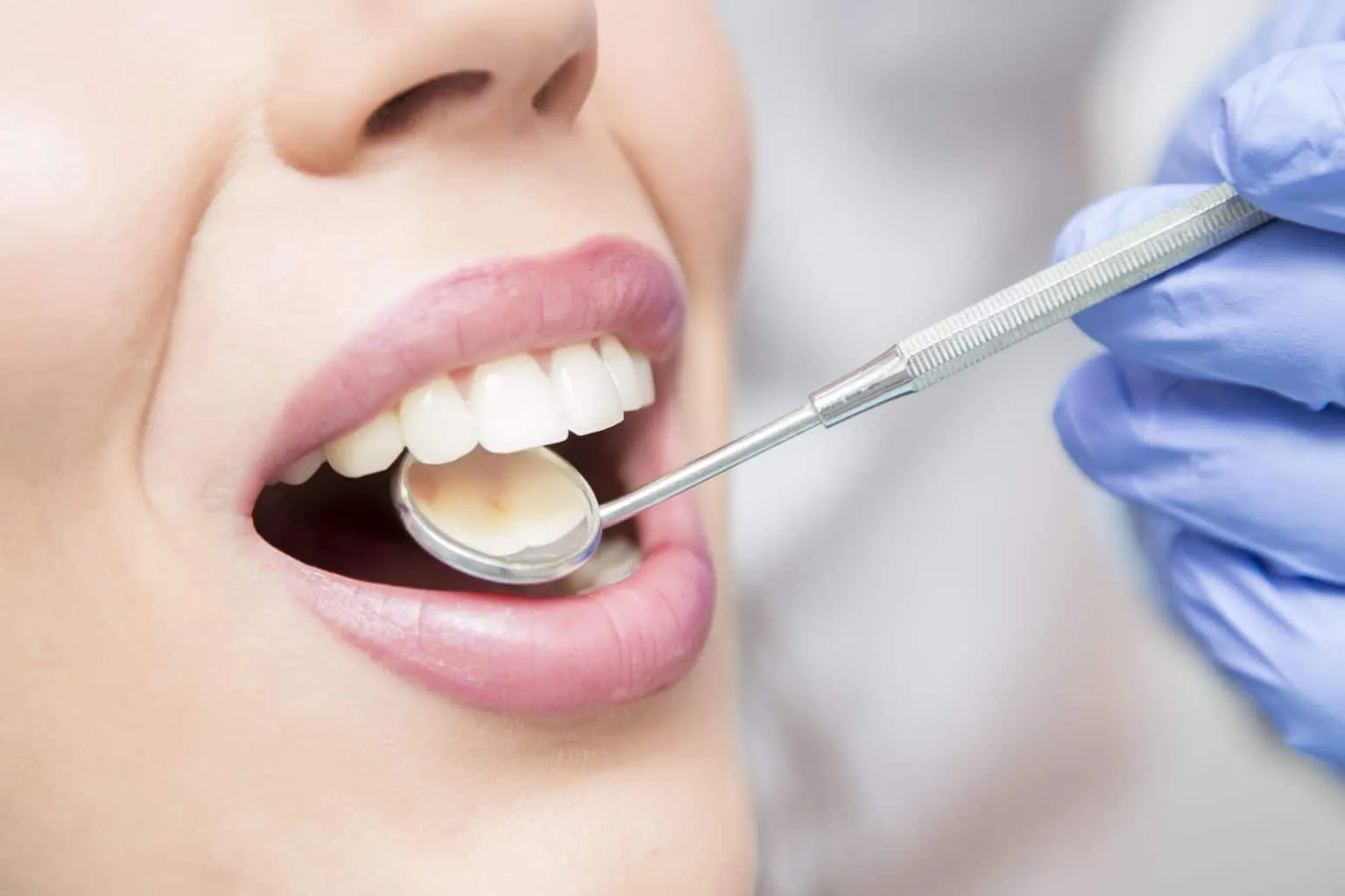 /img/29072-teeth-whitening-maintenance.webp