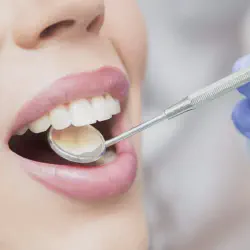/img/29072-teeth-whitening-maintenance.webp