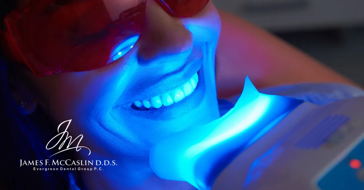 29072 whitening toothpaste