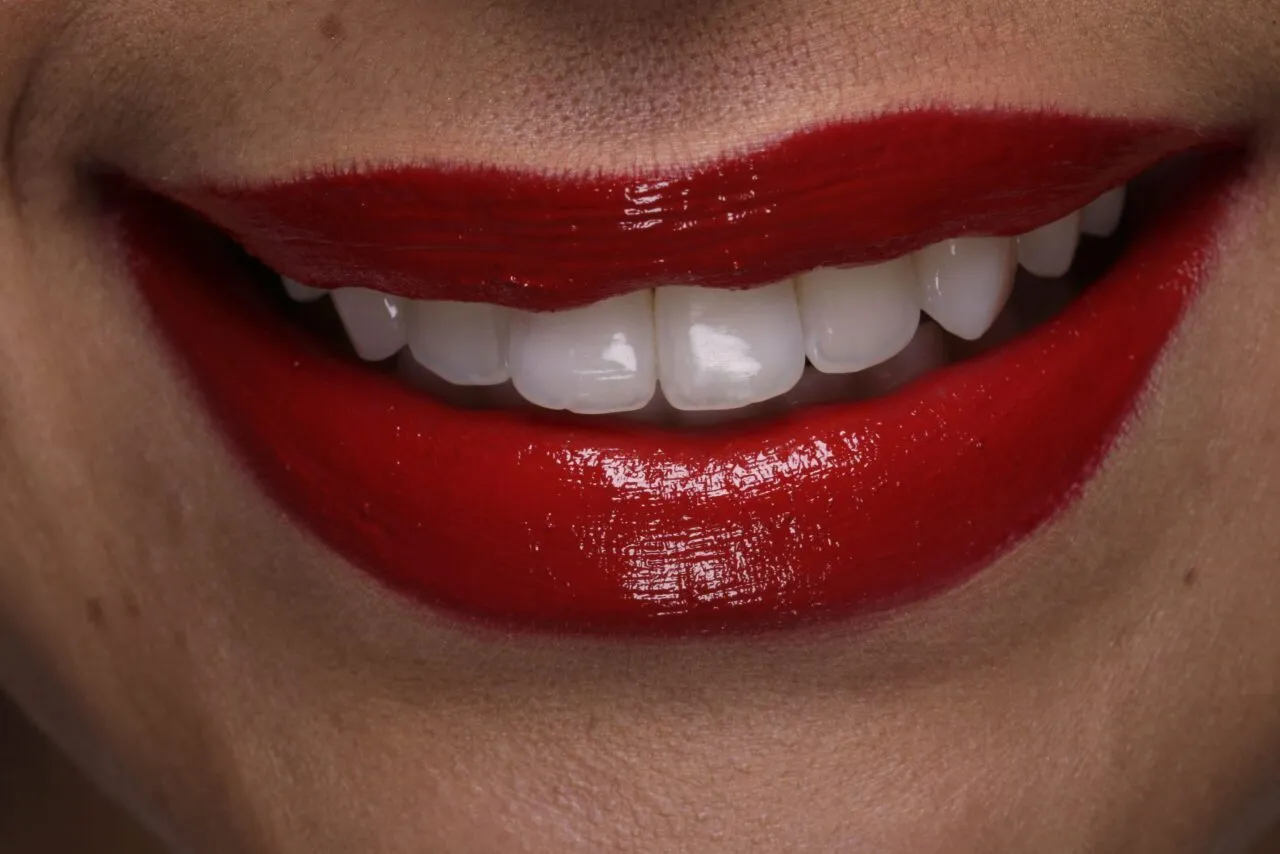 29075 baking soda teeth whitening