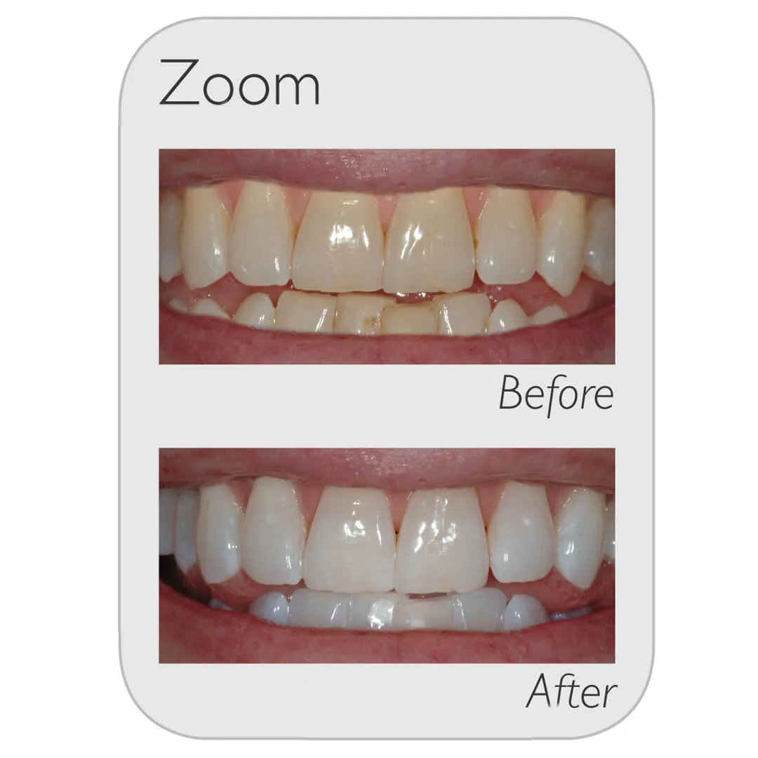29075 whitening toothpaste