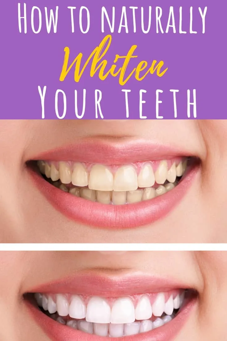 /img/29076-healthy-teeth-brushing.webp