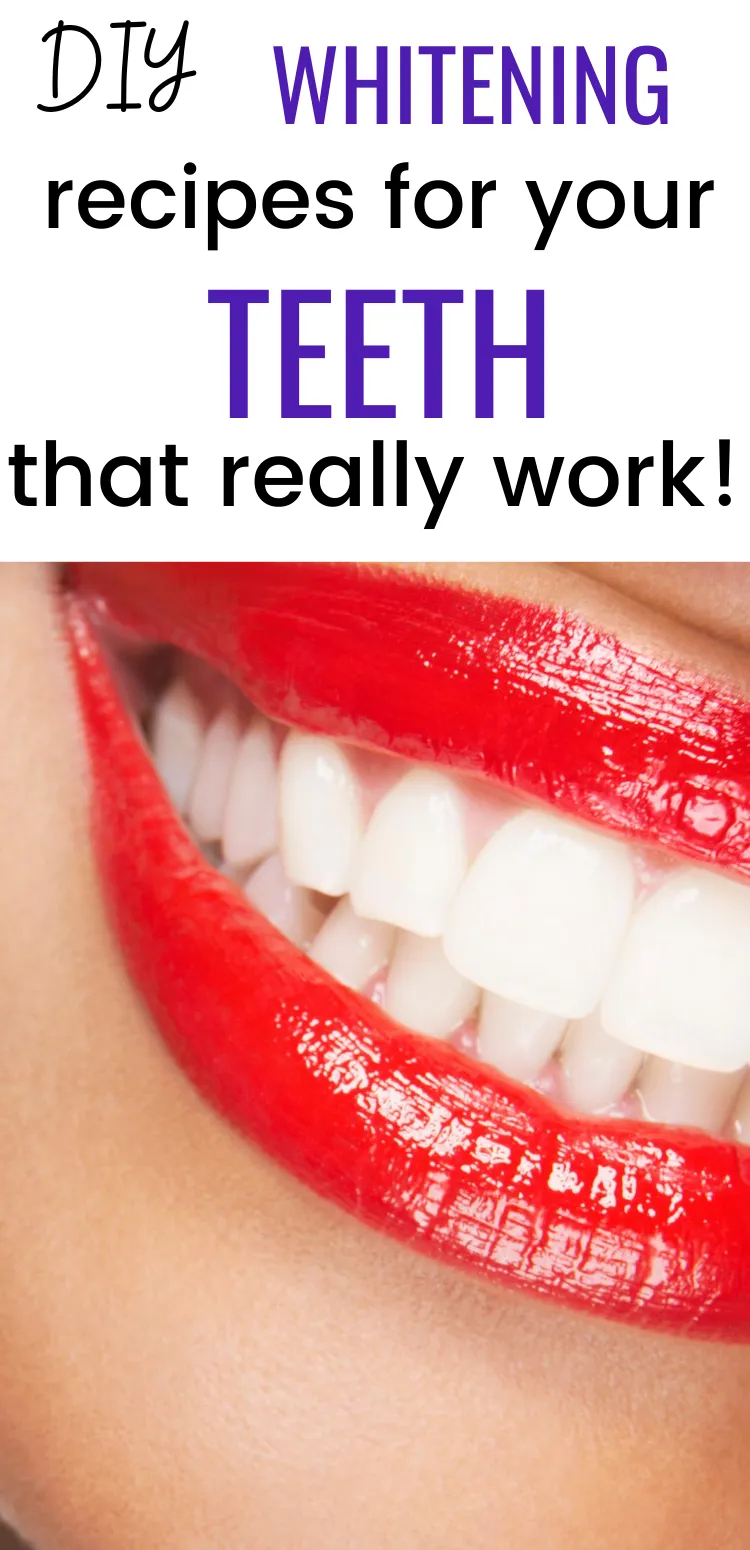 29076 stained teeth causes