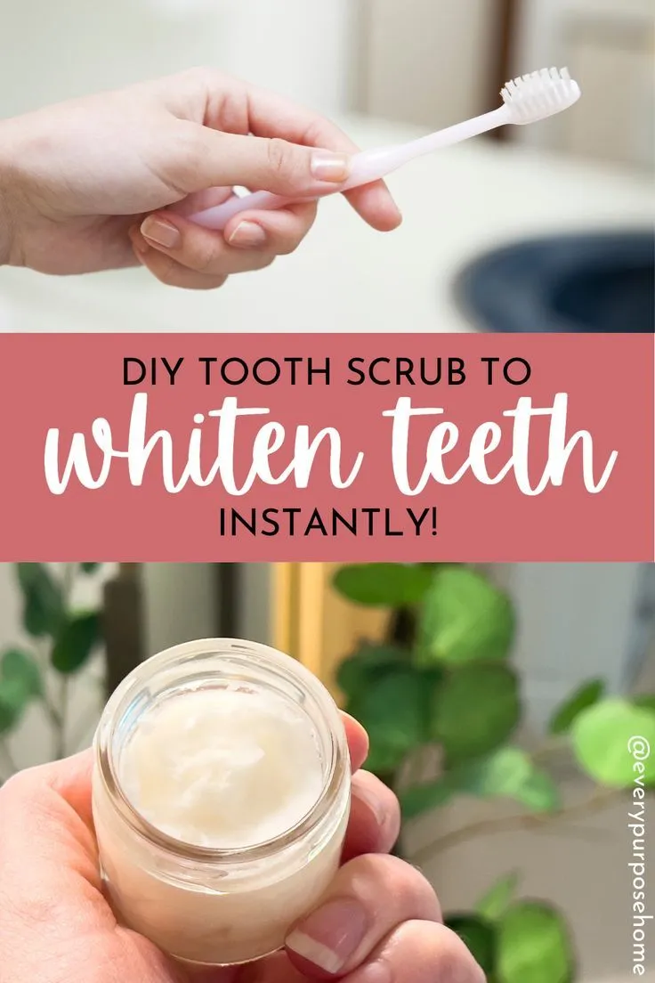 29076 teeth whitening overview