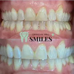 /img/29078-teeth-whitening-chandler-az-confident-smile.webp