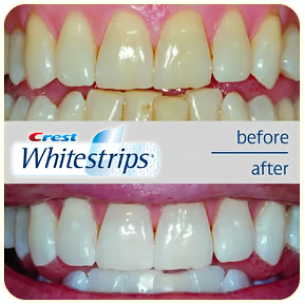 29079 crest whitening strip application