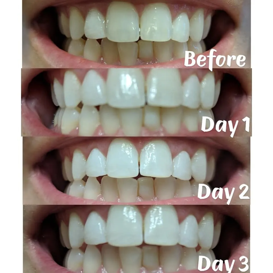 29079 sensitive teeth care