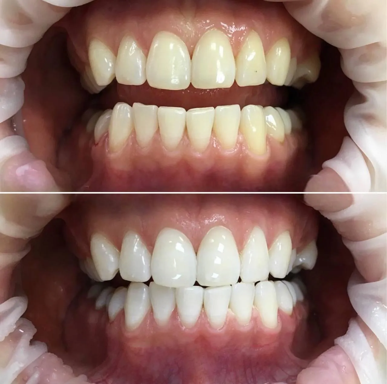29085 joliet dentist consultation